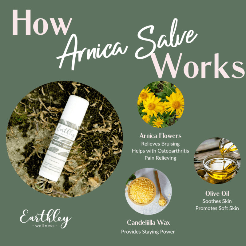 arnica salve- for sore muscles + bruises - Ivory Soul